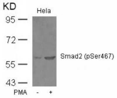 Western Blot: Smad2 [p Ser467] AntibodyBSA Free [NBP2-54771]